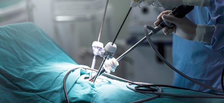 Rushi-surgical-Hospital-laparoscopic-Surgery