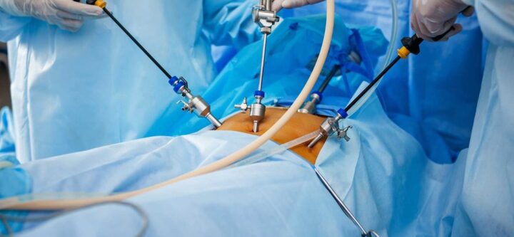 endoscopic-surgery